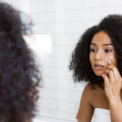 Acne Facial: Why You Need A Professional Treatment